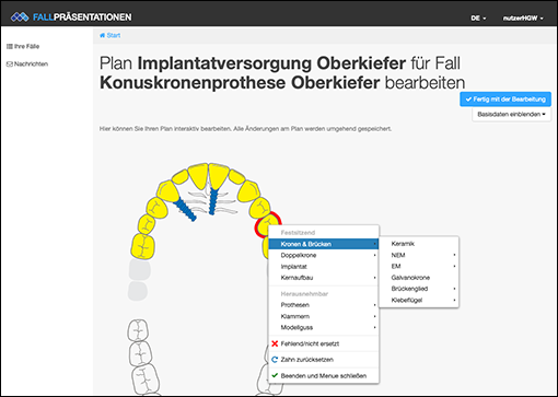 Screen Plan bearbeiten
